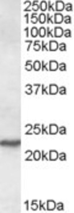 Invitrogen SAR1A Polyclonal Antibody 100 &mu;g; Unconjugated:Antibodies,