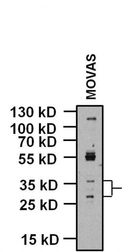 Invitrogen KCNMB1 Polyclonal Antibody 100 &mu;g | Buy Online | Invitrogen&trade; | Fisher Scientific