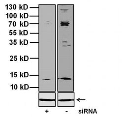 Invitrogen KCNMB1 Polyclonal Antibody 100 &mu;g | Buy Online | Invitrogen&trade; | Fisher Scientific