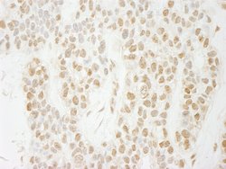 PA1 Polyclonal Antibody, Bethyl Laboratories:Antibodies:Primary Antibodies