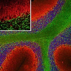 Invitrogen alpha Internexin Polyclonal Antibody 100 &mu;L; Unconjugated:Antibodies,