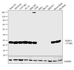 Invitrogen PGP9.5 Polyclonal Antibody 100 &mu;L; Unconjugated:Antibodies,