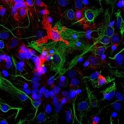 Invitrogen Coronin 1A Polyclonal Antibody 100 &mu;L; Unconjugated:Antibodies,