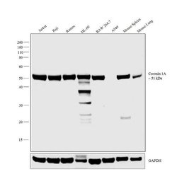 Invitrogen Coronin 1A Polyclonal Antibody 100 &mu;L; Unconjugated:Antibodies,