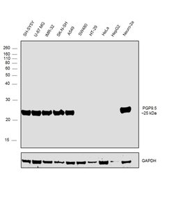 Invitrogen PGP9.5 Polyclonal Antibody 100 &mu;L; Unconjugated:Antibodies,