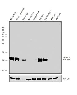 Invitrogen PGP9.5 Polyclonal Antibody 100 &mu;L; Unconjugated:Antibodies,
