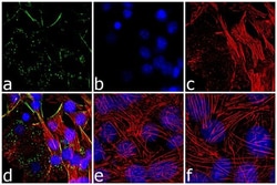 Invitrogen Perilipin 1 Polyclonal Antibody 100 &mu;g; Unconjugated:Antibodies,