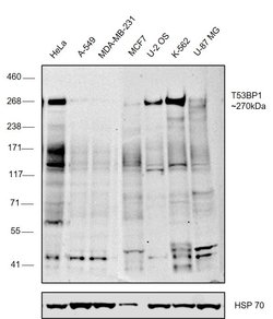Invitrogen 53BP1 Polyclonal Antibody 100 &mu;L; Unconjugated:Antibodies,