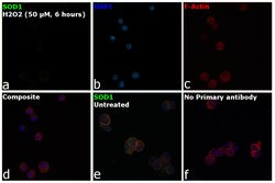 Invitrogen SOD1 Polyclonal Antibody 100 &mu;L; Unconjugated:Antibodies,