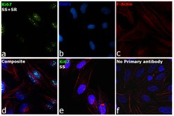Invitrogen Ki-67 Polyclonal Antibody 500 &mu;L; Unconjugated:Antibodies,