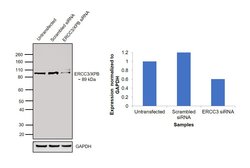Invitrogen XPB Polyclonal Antibody 50 &mu;g; Unconjugated:Antibodies, Polyclonal