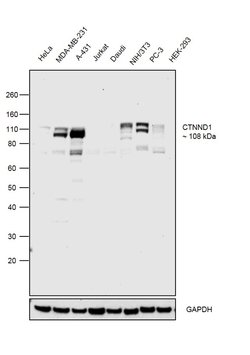 Invitrogen delta Catenin Polyclonal Antibody 50 &mu;L; Unconjugated:Antibodies,