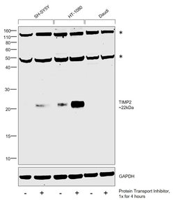 Invitrogen TIMP2 Polyclonal Antibody 50 &mu;g | Buy Online | Invitrogen&trade; | Fisher Scientific