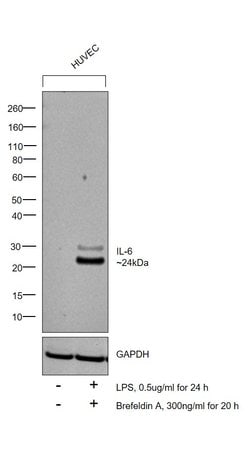 Invitrogen IL-6 Polyclonal Antibody 200 &mu;L; Unconjugated:Antibodies,