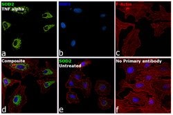 Invitrogen SOD2 Polyclonal Antibody 50 &mu;g; Unconjugated:Antibodies,