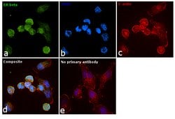 Invitrogen Estrogen Receptor beta Polyclonal Antibody 50 &mu;g; Unconjugated:Antibodies,