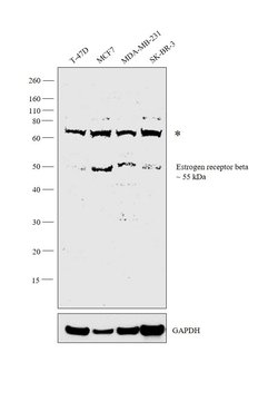 Invitrogen Estrogen Receptor beta Polyclonal Antibody 50 &mu;g; Unconjugated:Antibodies,