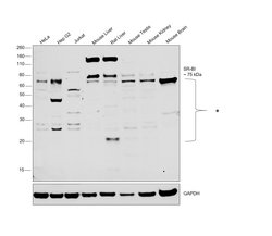 Invitrogen SR-BI Polyclonal Antibody 100 &mu;L; Unconjugated:Antibodies,