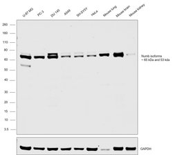 Invitrogen NUMB Polyclonal Antibody 50 &mu;g | Buy Online | Invitrogen&trade; | Fisher Scientific