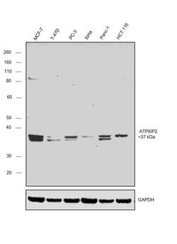 Invitrogen ATP6IP2 Polyclonal Antibody 50 &mu;g; Unconjugated:Antibodies,