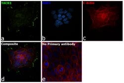 Invitrogen&trade;&nbsp;TACR1 Polyclonal Antibody