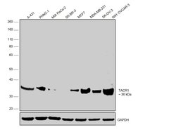 Invitrogen TACR1 Polyclonal Antibody 100 &mu;L | Buy Online | Invitrogen&trade; | Fisher Scientific