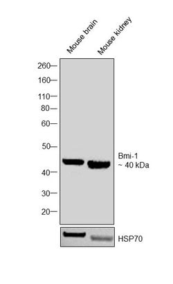 BMI-1 Polyclonal Antibody, Invitrogen 50 &mu;g; Unconjugated:Antibodies,