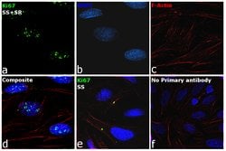 Invitrogen Ki-67 Polyclonal Antibody 1 mL | Buy Online | Invitrogen&trade; | Fisher Scientific