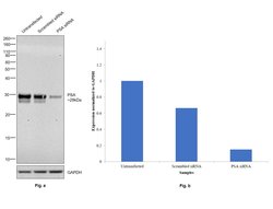 PSA Polyclonal Antibody, Invitrogen 1 mL; Unconjugated:Antibodies, Polyclonal