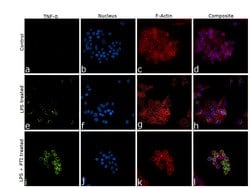 TNF alpha Polyclonal Antibody:Antibodies, Polyclonal