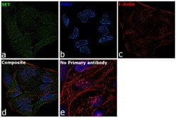 Invitrogen SET Polyclonal Antibody 100 &mu;g; Unconjugated:Antibodies,