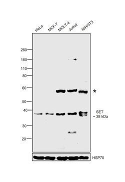 Invitrogen SET Polyclonal Antibody 100 &mu;g; Unconjugated:Antibodies,