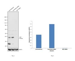 Invitrogen SET Polyclonal Antibody 100 &mu;g; Unconjugated:Antibodies,