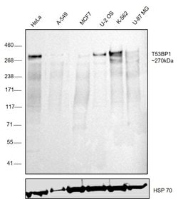 Invitrogen 53BP1 Polyclonal Antibody 100 &mu;L; Unconjugated:Antibodies,
