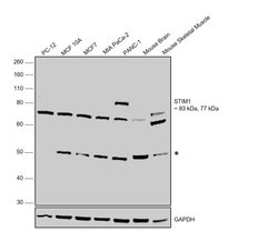 Invitrogen STIM1 Polyclonal Antibody 100 &mu;L; Unconjugated:Antibodies,
