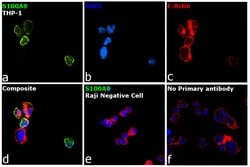 S100A9 Polyclonal Antibody:Antibodies, Polyclonal