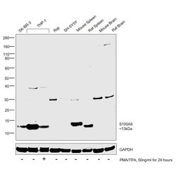 S100A9 Polyclonal Antibody:Antibodies, Polyclonal