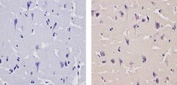 Invitrogen CaMKIV Polyclonal Antibody 100 &mu;g; Unconjugated:Antibodies,