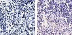 Invitrogen CaMKIV Polyclonal Antibody 100 &mu;g; Unconjugated:Antibodies,