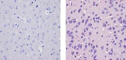 Invitrogen CaMKIV Polyclonal Antibody 100 &mu;g; Unconjugated:Antibodies,