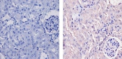 Invitrogen CaMKI Polyclonal Antibody 100 &mu;g; Unconjugated:Antibodies,