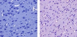 Invitrogen CaMKI Polyclonal Antibody 100 &mu;g; Unconjugated:Antibodies,