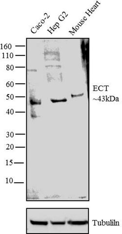Invitrogen PCYT2 Polyclonal Antibody 100 &mu;g; Unconjugated:Antibodies,
