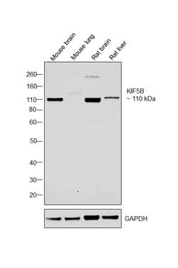 Invitrogen Kinesin 5B Polyclonal Antibody 100 &mu;g; Unconjugated:Antibodies,