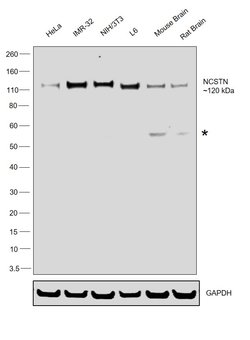 Nicastrin Polyclonal Antibody, Invitrogen 100 &mu;g; Unconjugated:Antibodies,