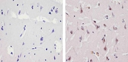 Invitrogen Ubiquilin 1 Polyclonal Antibody 100 &mu;g; Unconjugated:Antibodies,