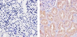 Invitrogen Ubiquilin 1 Polyclonal Antibody 100 &mu;g; Unconjugated:Antibodies,