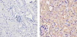 Invitrogen Ubiquilin 1 Polyclonal Antibody 100 &mu;g; Unconjugated:Antibodies,