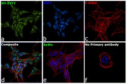 Invitrogen RARB Polyclonal Antibody 100 &mu;L; Unconjugated:Antibodies,