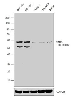 Invitrogen RARB Polyclonal Antibody 100 &mu;L; Unconjugated:Antibodies,